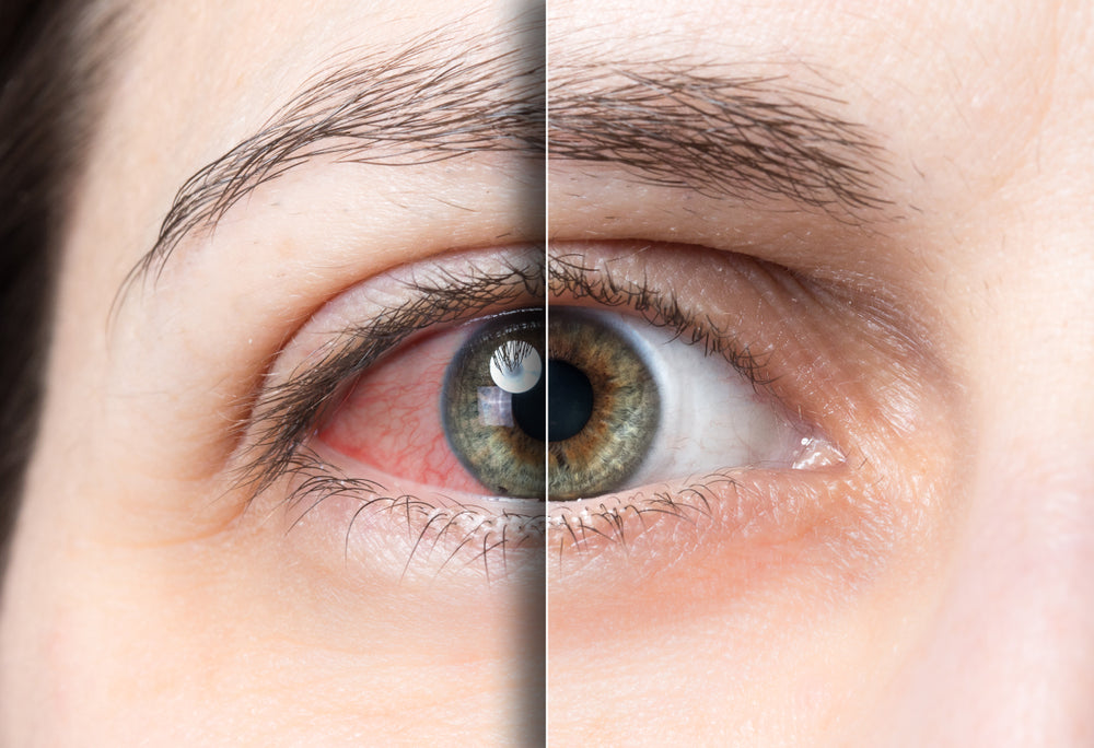 WHAT MAKES ASTAXANTHIN SO GOOD FOR THE EYES?